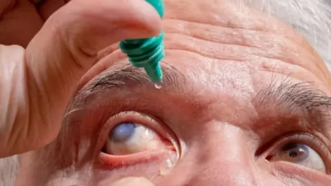 Glaucoma Treatment